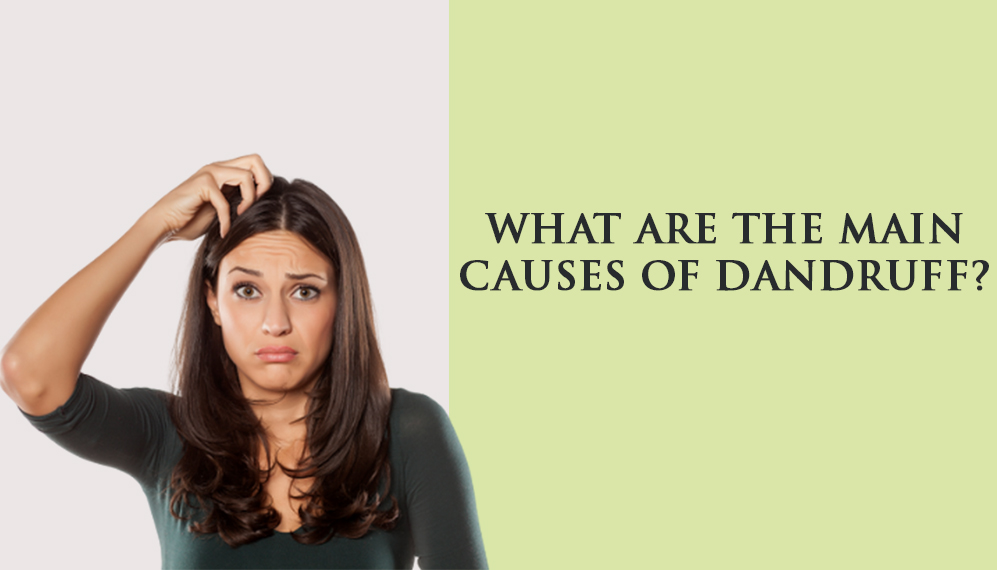 What are the main causes of Dandruff?