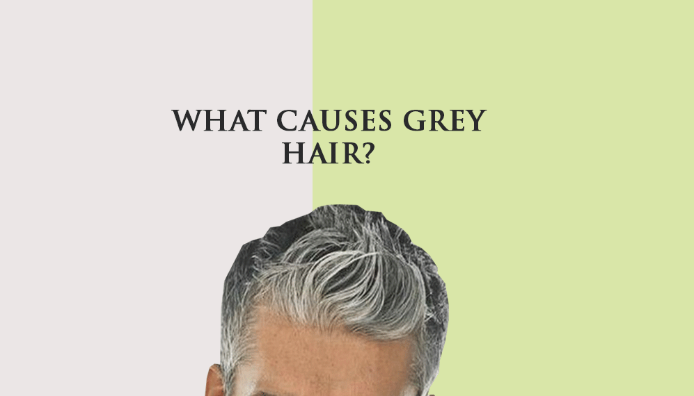 What causes grey hair? How to prevent them from occurring?
